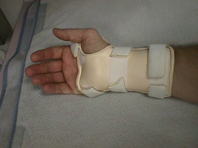 Wristsplint